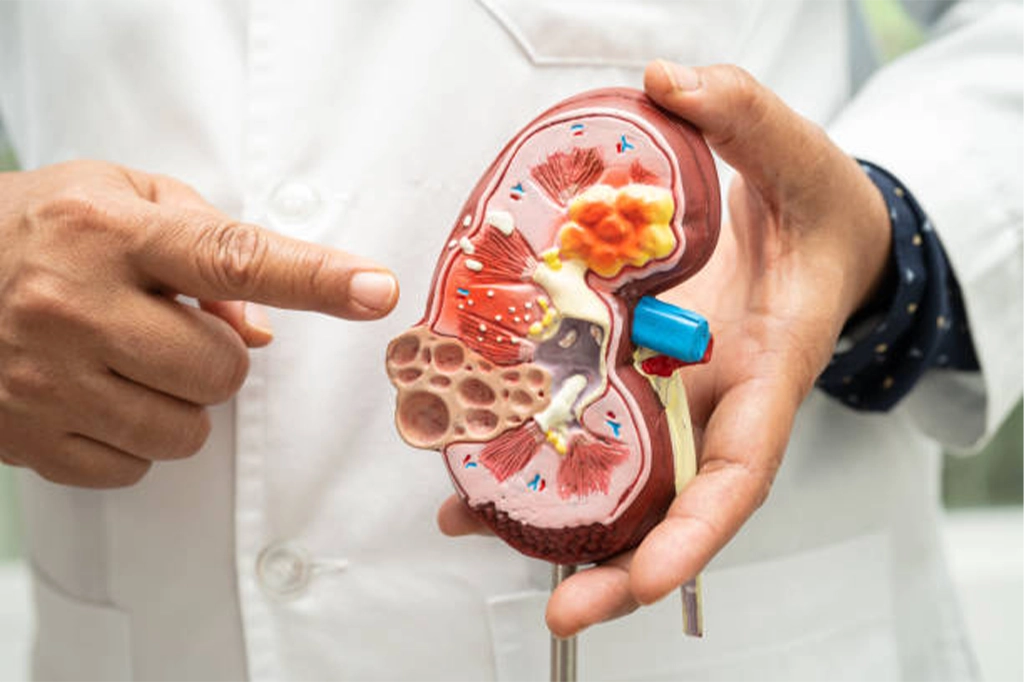 Best Nephrology in Kanpur